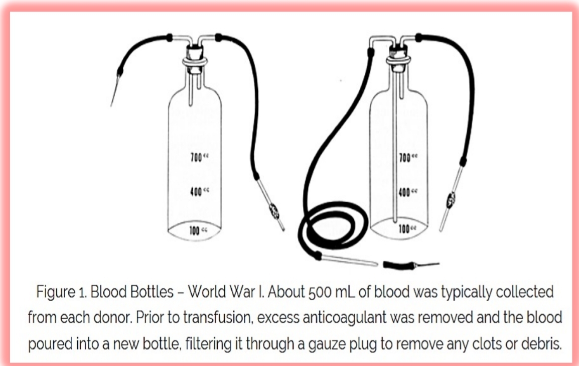 <ul><li><p>Edward Lindemann > Vein-to-vein blood transfusion was carried out using multiple syringes and a special cannula for puncturing the vein through the skin</p></li></ul><p></p>