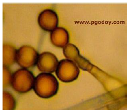 <p>proliferación </p>