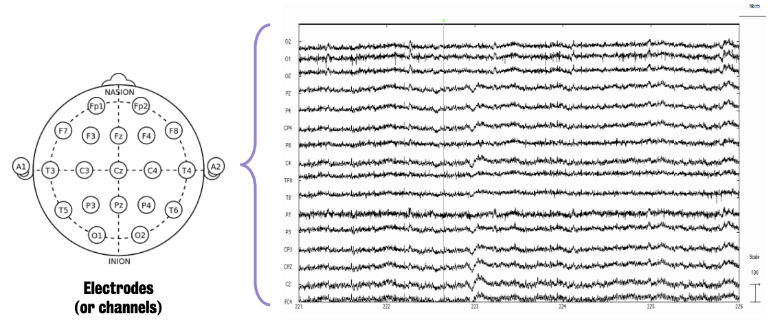 Plotted recorded EEG
