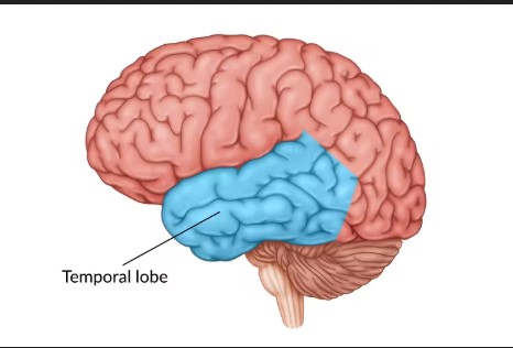 <p>The <mark data-color="#a8c48f" style="background-color: rgb(168, 196, 143); color: inherit;">temporal lobe</mark> is located on the sides of the brain, playing a key role in processing auditory information and is involved in memory and emotion.</p>