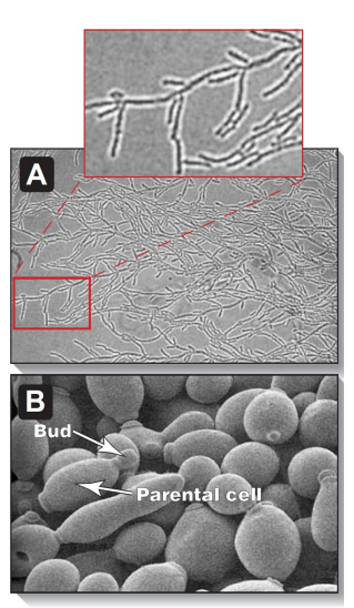 <p><strong>Yeasts</strong> – unicellular, ovoid/spherical, colonies resemble bacteria<br><strong>Molds</strong> – multicellular, filamentous, form <strong>hyphae</strong> (masses called <strong>mycelia</strong>)<br>Many fungi show <strong>dimorphism</strong> (exist as either mold or yeast)<br>Systemic fungal <strong>infection</strong> may exist as <strong>mold</strong> in the environment and <strong>yeast</strong> in the body</p>