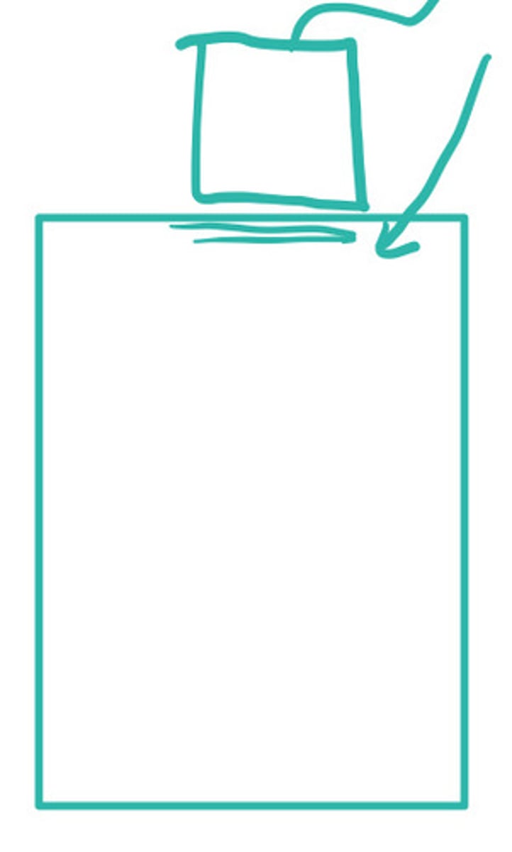 <p>What does this image demonstrate</p>