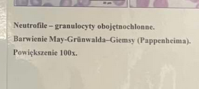 <p>zapalenie ostre, pierwsza lionia obrony organizmu, budowa jądra pozwala na szybkie ptrzeciskanie się ścianę naczyń włsosowatych, ziranistości są antygrzybicze i antybakteryjne oraz zawierają substancje pozwalające przeciskać się przez substancję międzykomórkową tkanek, fagocytują</p>