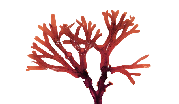 <p>Which protist is this? </p>