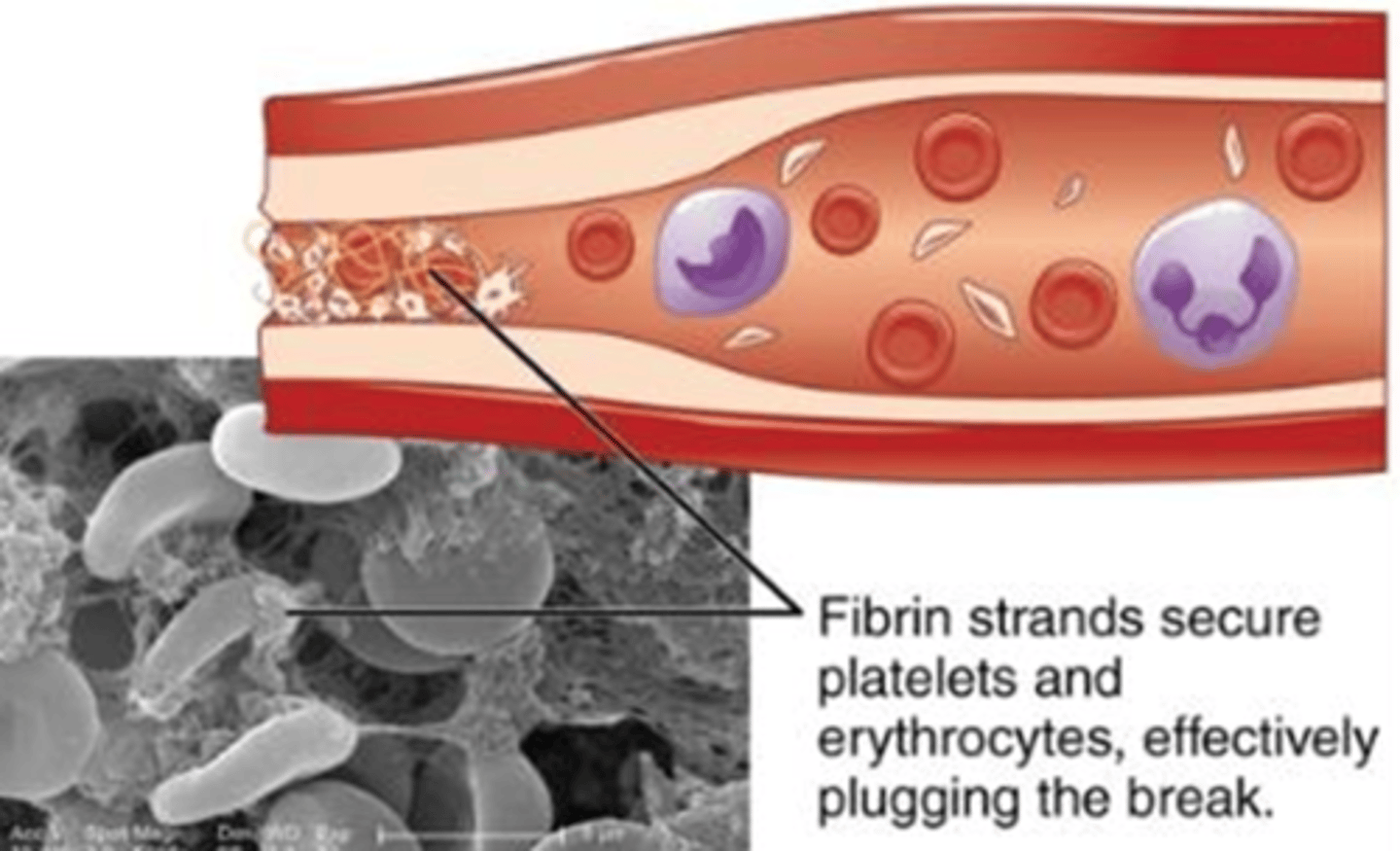 <p>The process of blood clot formation, involving a series of complex reactions that result in the conversion of fibrinogen into fibrin, which forms a mesh-like structure to seal the damaged blood vessel.</p>