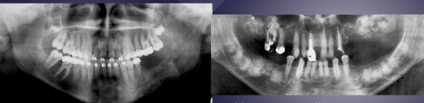 <p>differentiate between the 2 radiographs</p>