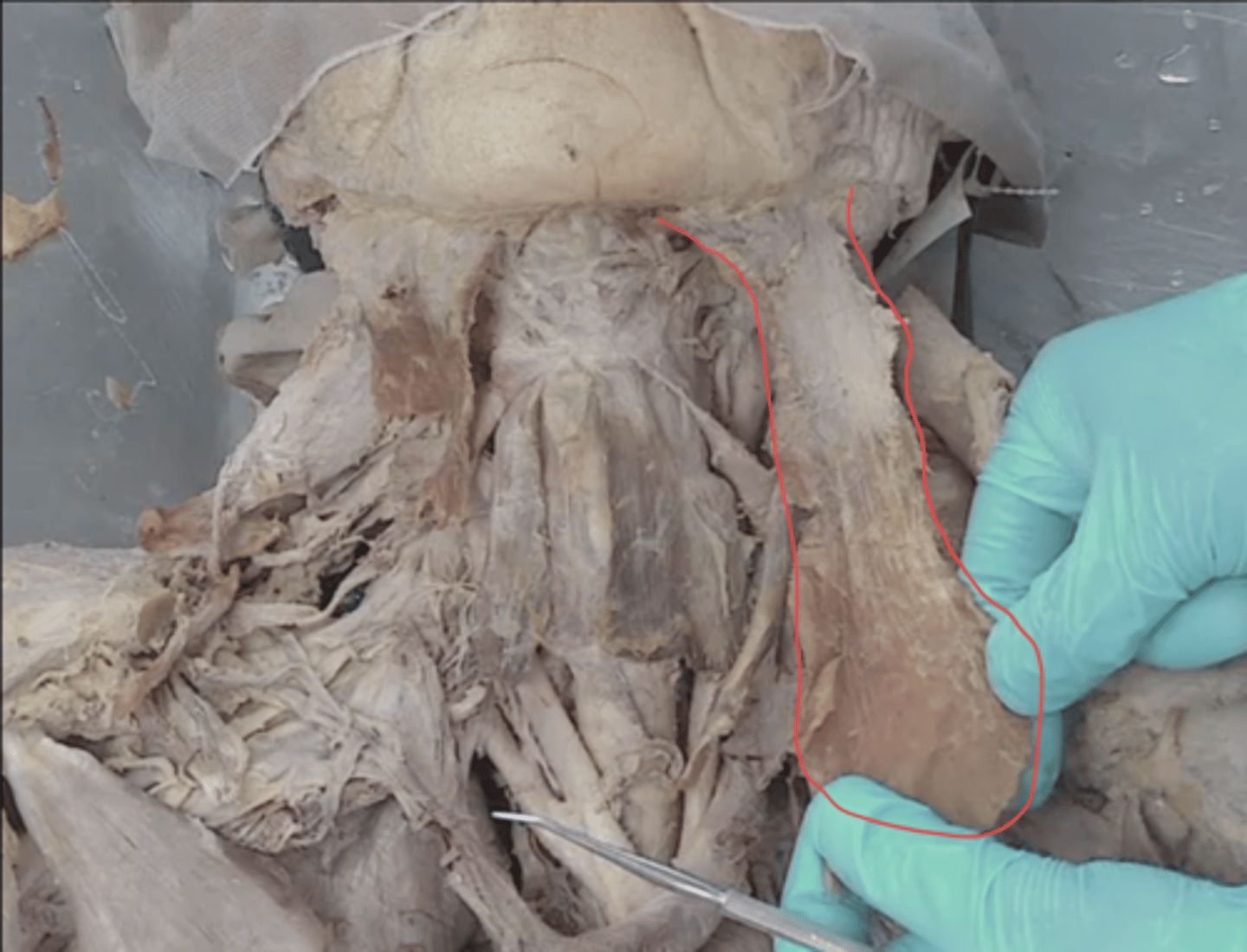 <p>identify this muscle</p>