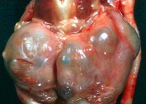 <p>What organ is visible and what is wrong?</p>