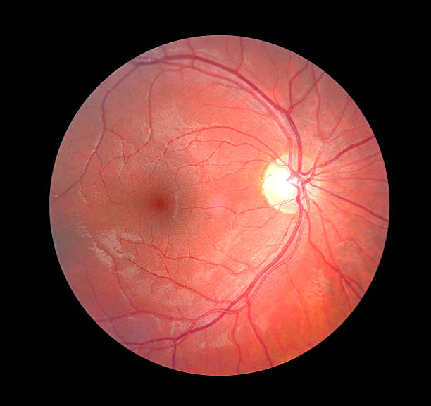 <p>Subject sits and looks at distant object over examiner’s shoulder. Observe right eye with your right eye and vice versa. <strong>Opthalmoscope </strong>turned on and held at arms lenght, directed so light is shining into subjects pupil and observe.</p><p>Yellow is optic disc, red is macula lutea, pink is everywhere else. Arteries brighter red than veins</p>
