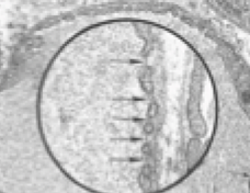 <p>What type of capillary is this image?</p>