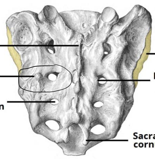<p>what component of the sacrum is this?</p>