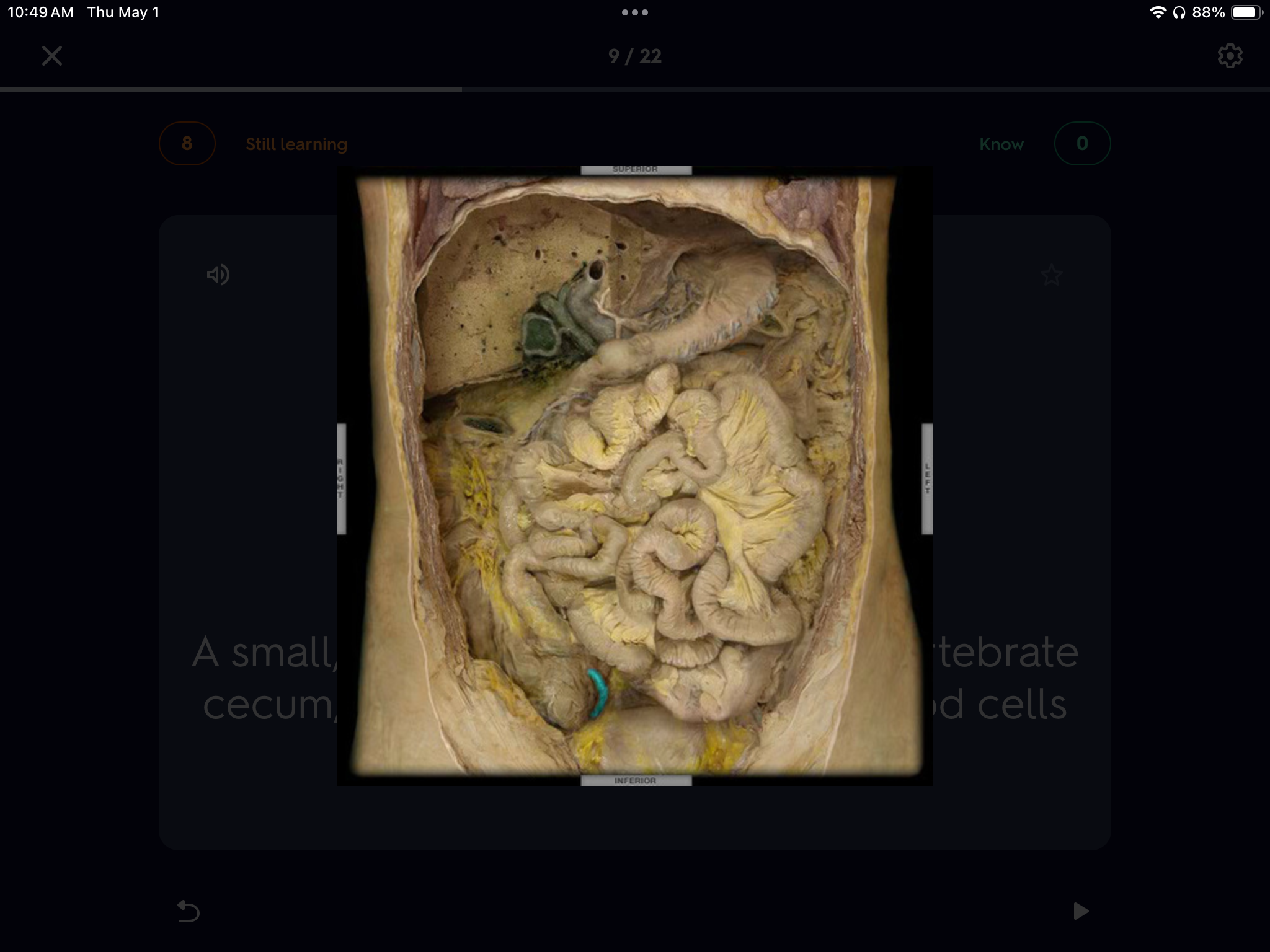 <p>What is the name of this worm-like structure highlighted? </p>