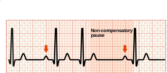 <p>What ECG trace is this?</p>