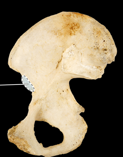<p>Hip bone, medial view, right ilium</p>