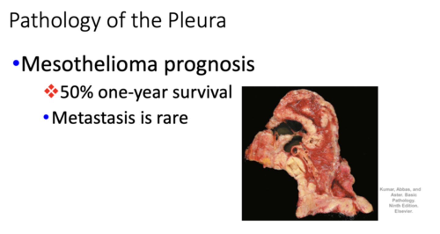 <p>50% one-year survival</p>