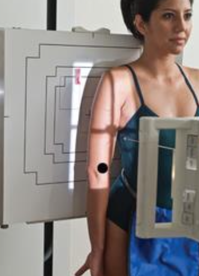 <p>lateral humerus</p><ul><li><p>arm internally rotated </p></li><li><p>palm facing laterally&nbsp;</p></li></ul><p></p>