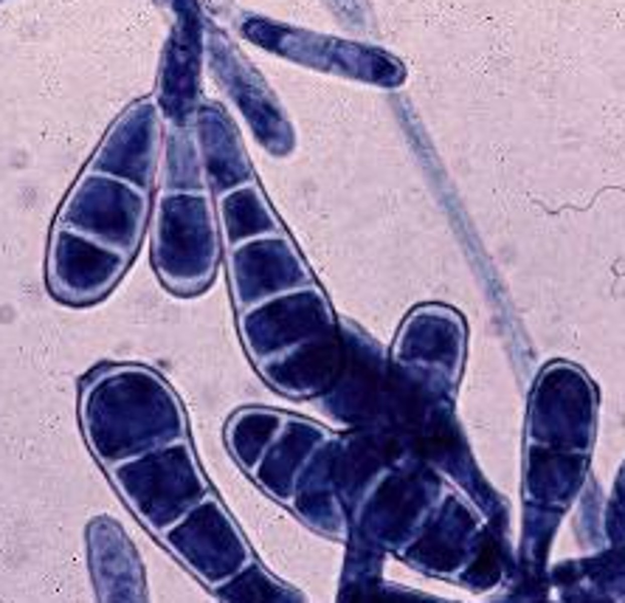 <p>Microsporum and Epidermophyton</p>