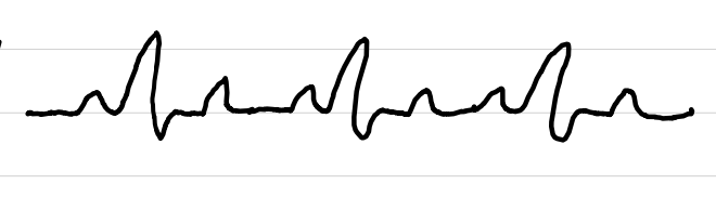 <ul><li><p>rate: 60-100 bpm</p></li><li><p>rhythm: regular</p></li><li><p>P waves: normal</p></li><li><p>PR interval: 0.12-0.20 sec</p></li><li><p>QRS complexes: <0.10 sec</p></li><li><p>ST segments: normal</p></li></ul><p></p>