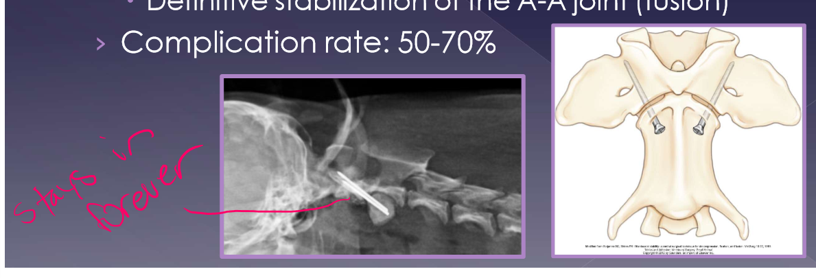 <ul><li><p>Medical </p><ul><li><p>goal: stabilize joint while ligamentous structures heal </p></li><li><p>candidates </p><ul><li><p>acute onset of clinical signs without prior history </p></li><li><p>young dog with immature bone </p></li><li><p>financial constraints </p></li></ul></li><li><p>strict confinement: 6-8 weeks * very important </p></li><li><p>neck brace* </p></li><li><p>pain medications </p></li><li><p>Gabapentin, NSAID </p></li><li><p>good long term outcome </p></li></ul></li><li><p>surgical </p><ul><li><p><strong>gold standard </strong></p></li><li><p>goal </p><ul><li><p>reduce further compression of the spinal cord </p></li><li><p>definitive stabilization of the A-A joint (fusion) </p></li></ul></li><li><p>complication rate: 50-70% </p></li></ul></li><li><p>prognosis </p><ul><li><p>medical management </p><ul><li><p>good long term prognosis in 40% of cases </p></li><li><p>better if clinical signs <30days </p></li></ul></li><li><p>perioperative mortality - 10-30% </p></li></ul></li></ul><p></p>
