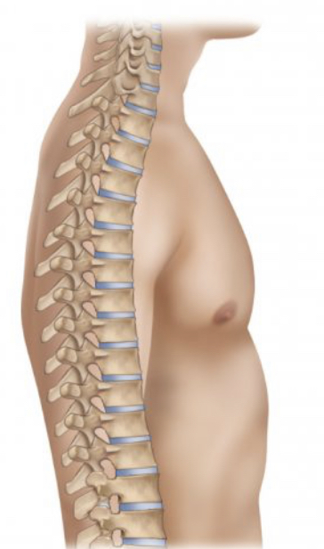 <p>hypokyphosis</p>
