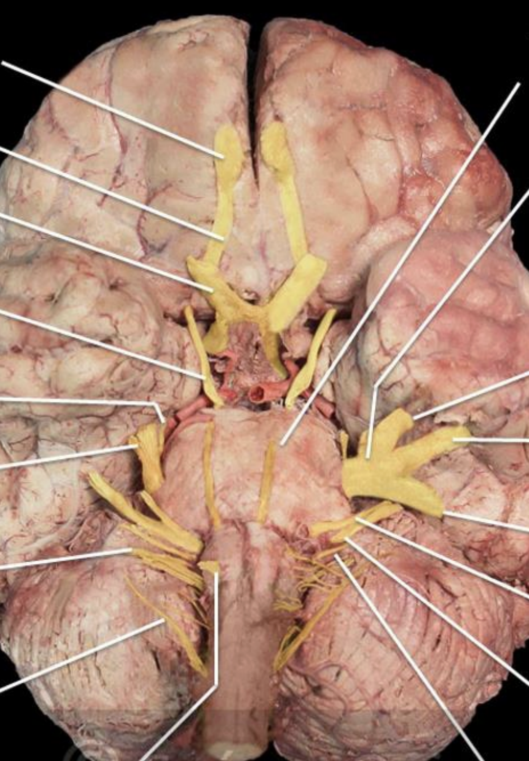 <p>Cranial Nerves</p>