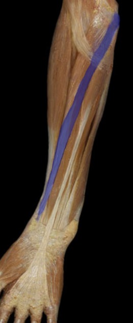<p>next to brachioradialis, on top of radius, tendon going to carpal region</p>