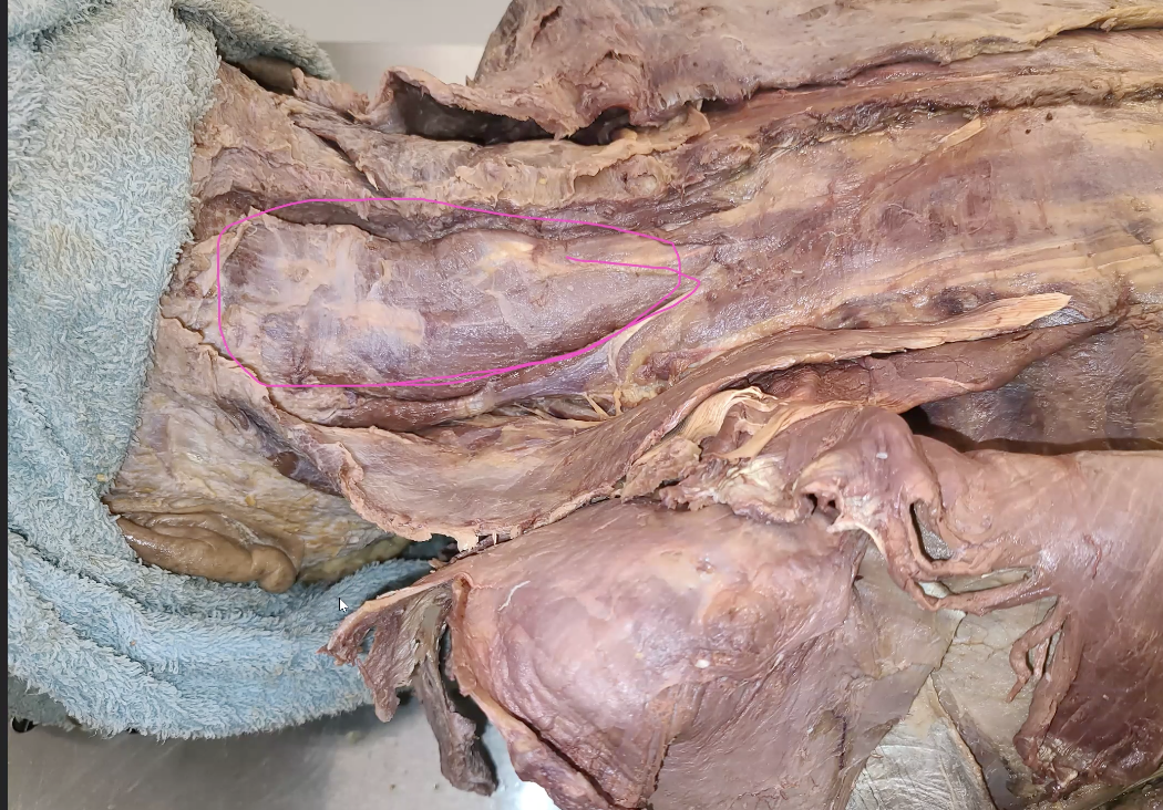 <p>what is the pink that is outlined </p>