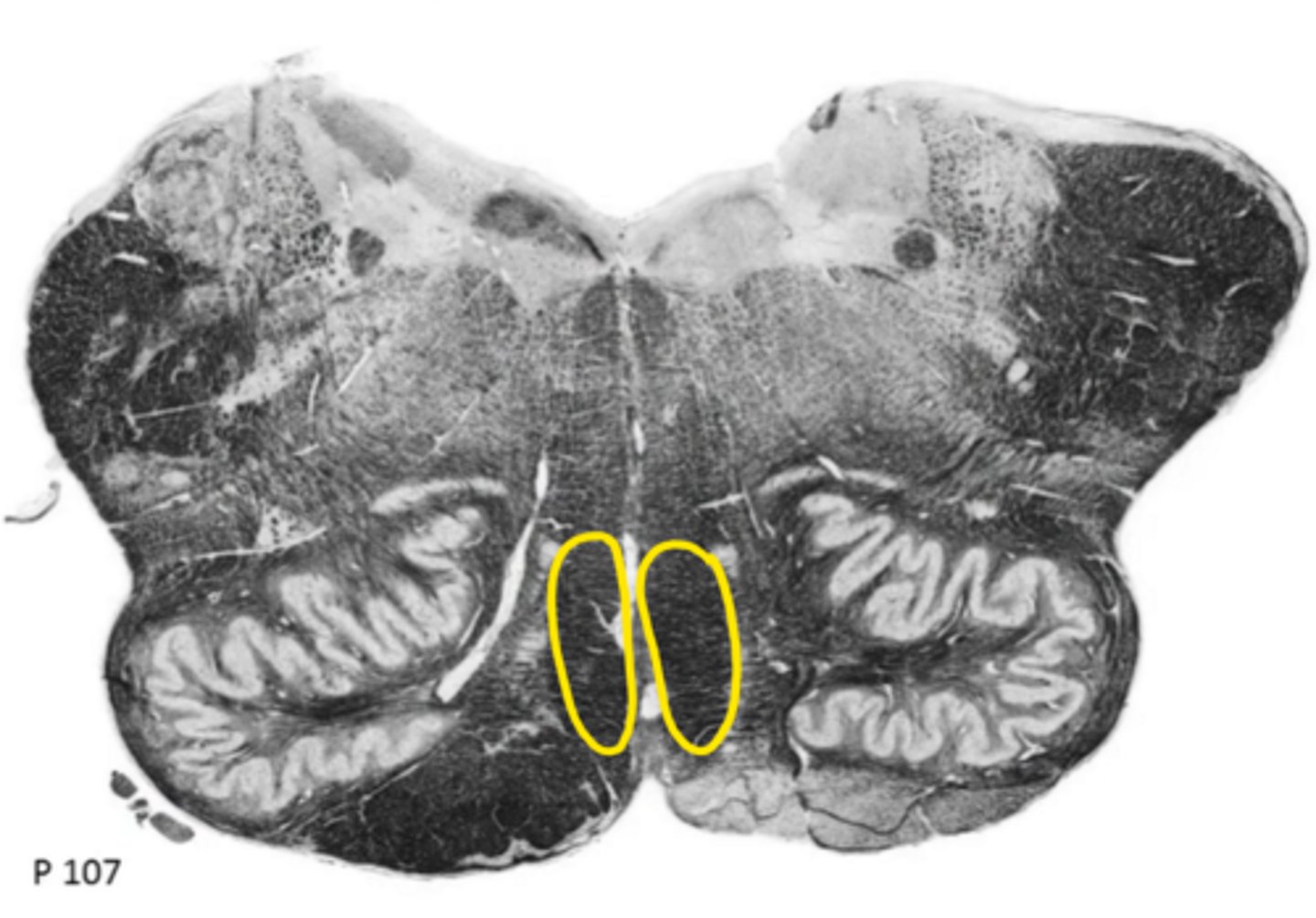 <p>ID the structure</p>
