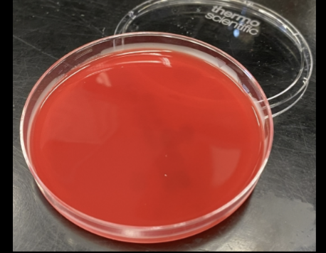 <p>Columbia CNA agar only allows growth for </p>