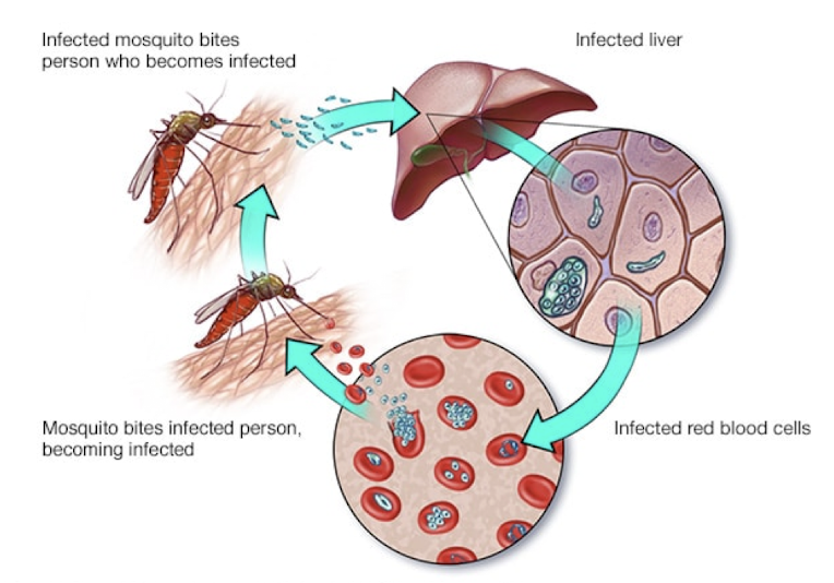 <p>Which urogenital protozoa is transmitted by <strong>infected mosquito bite </strong>or <strong>contaminated needle </strong>and causes <strong>malaria</strong>?</p><ul><li><p><span>fever, chills, shaking, vomiting, joint aches, fatigue, diarrhea</span></p></li></ul>