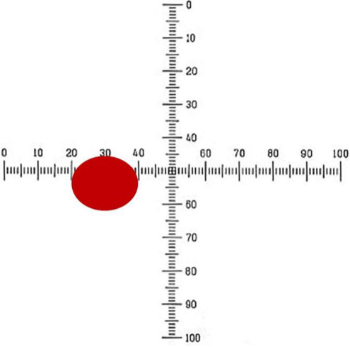 <p>What is the size (um) of the red blood cell at the 40 X objective lens giving the calibration of 5 um/ou</p>