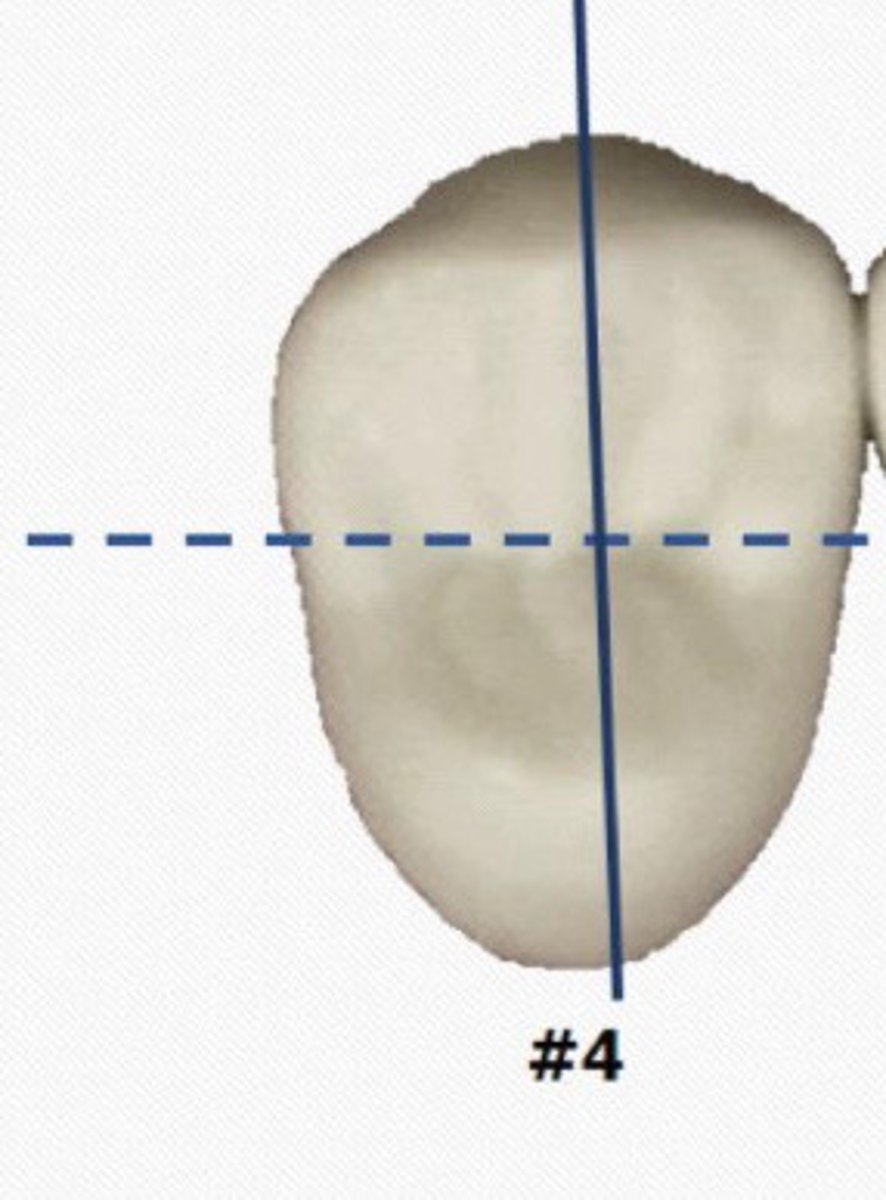 <p>Have narrower lingual surface than buccal</p>