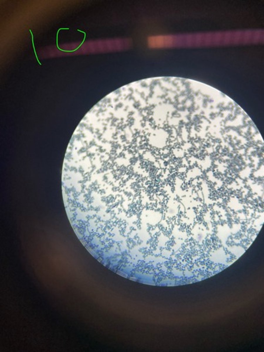 <p>What stain is this?</p>