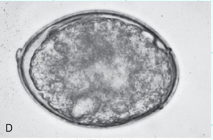 <p>What type egg?</p>