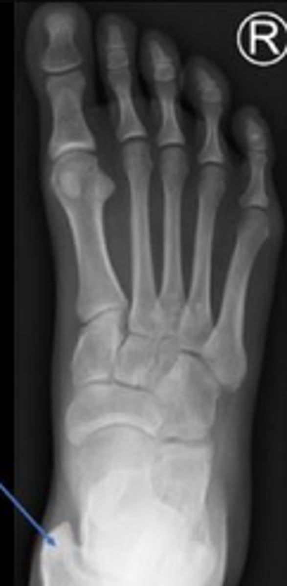 <p>What is the arrow pointing to?</p>