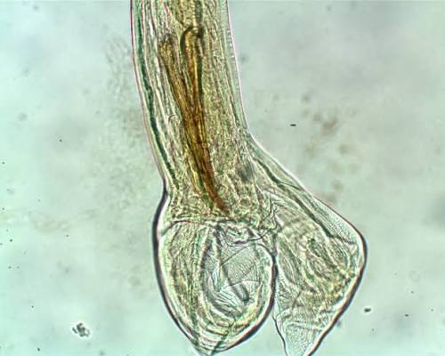 <p>Haemonchus contortus worm/barber’s pole</p>