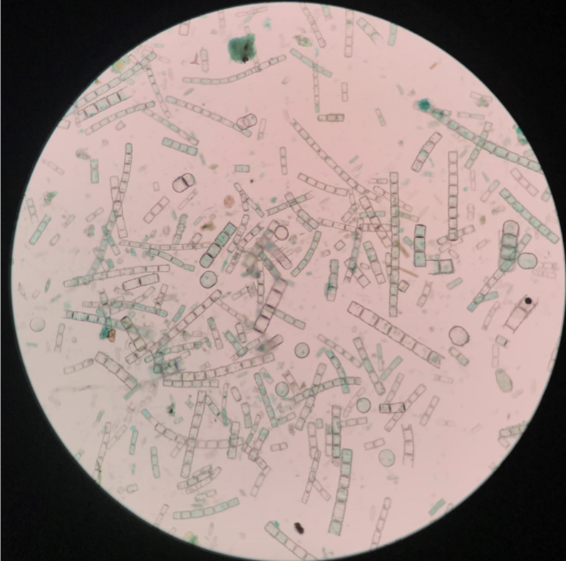 <p>Belongs to stramenopiles clade</p><p>Photosynthetic</p><p>Red algal secondary endosymbiosis</p><p>Unicellular and aquatic</p><p>Shell made from silicon dioxide (SiO2)</p><p>Appearance is coincident with grass evolution due to increase of Si from grassland runoff</p><p>Label the silicon dioxide tests</p>