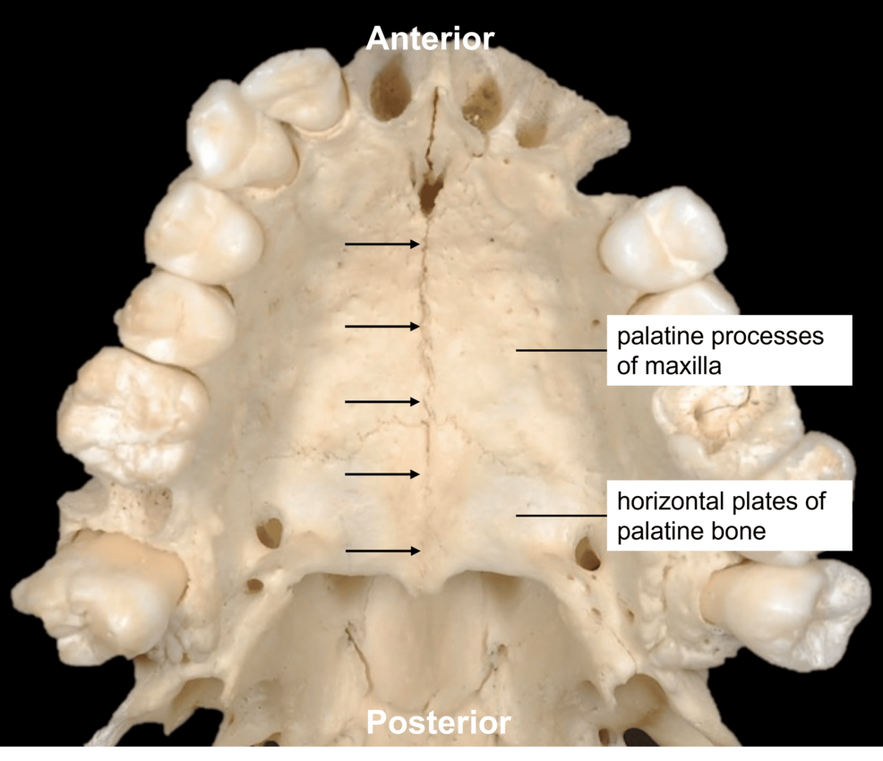 <p>between the roof of the mouth </p>