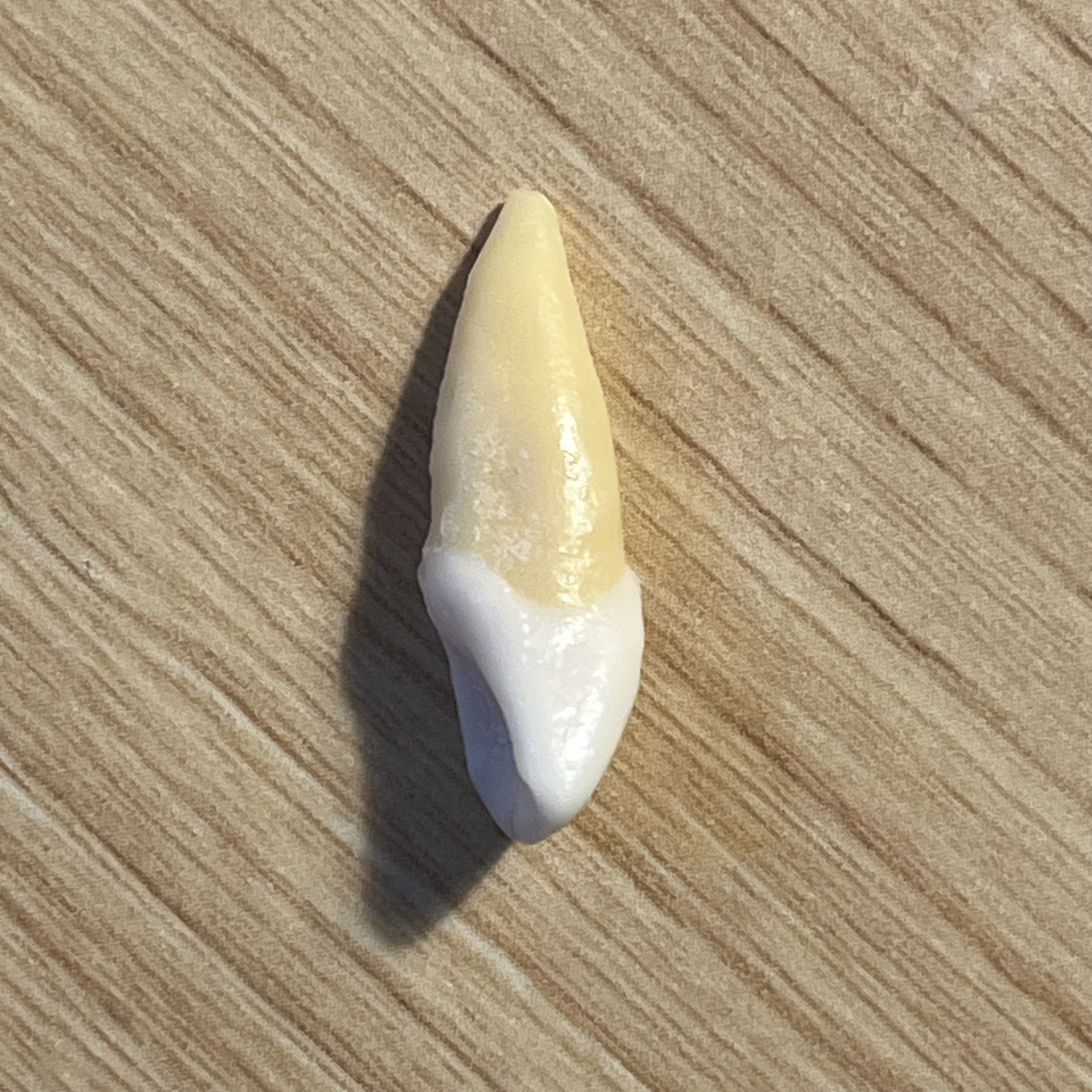 <p>What tooth is this (with view)?</p>