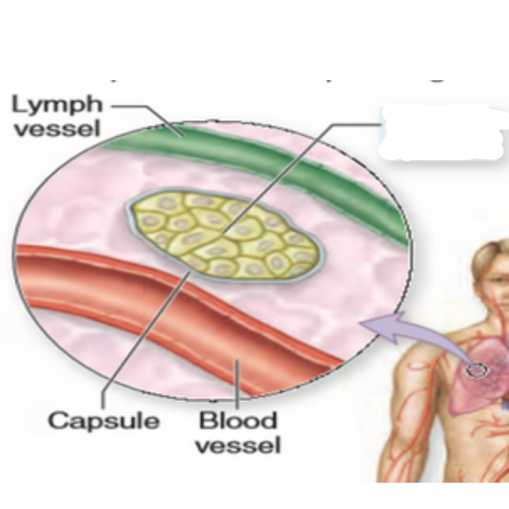 <p>What kind of tumor is this?</p>