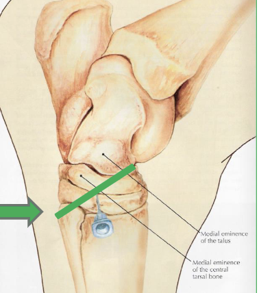 <p>what is desensitized in a distal intertarsal joint block</p>