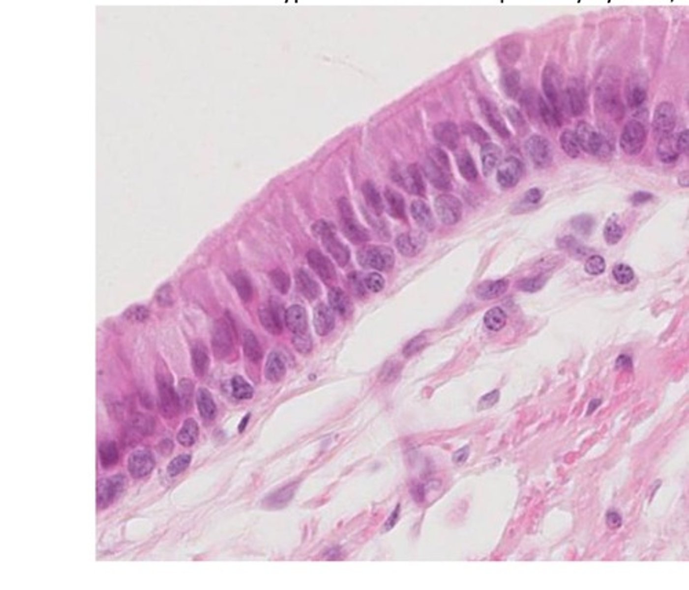 <p>Looks stratified but all cells will reach the basement membrane. Typical locations: Respiratory System, some in reproductive system</p>