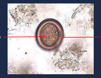 State the name of the left portion of the picture.