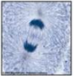 <p>Which phase of mitosis is depicted?</p>