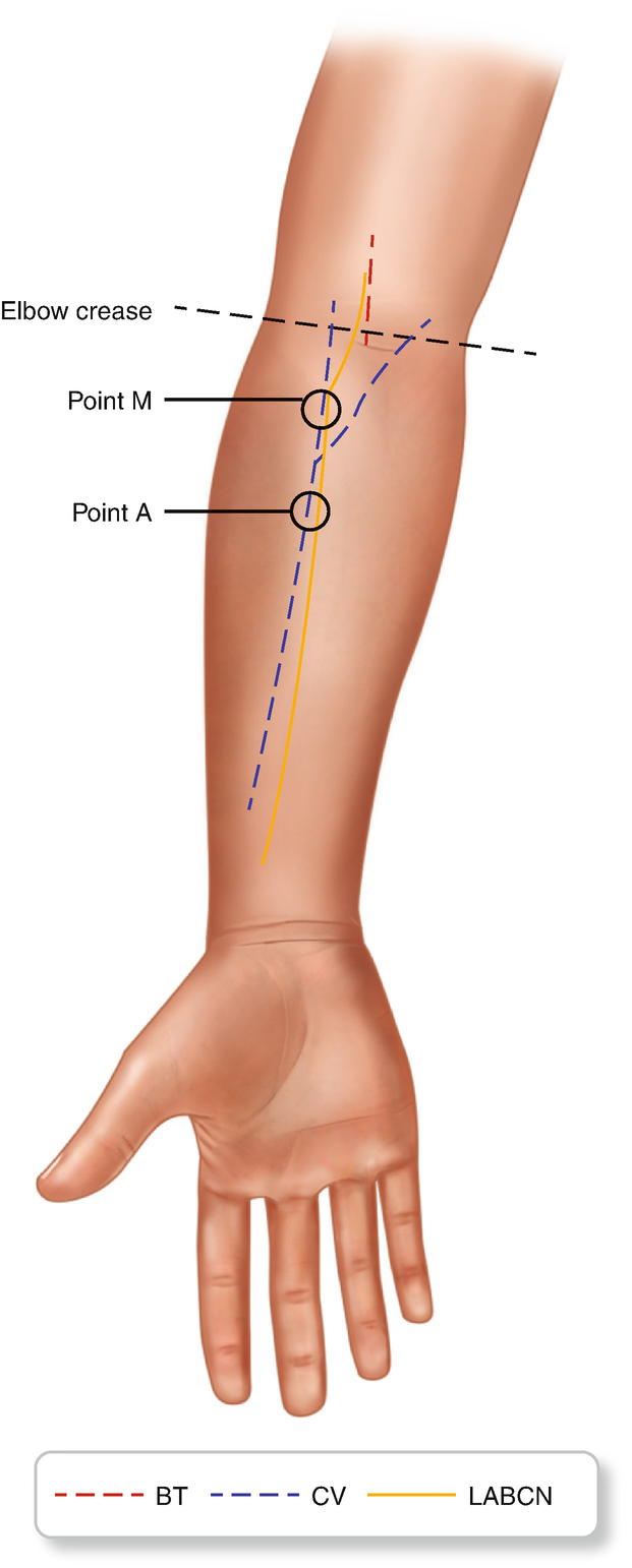 <p>Forearm region.</p>