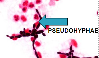 <p>tubular str that result from incomplete budding of yeast cells</p>