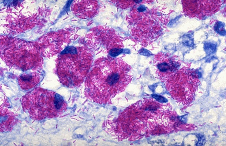 What example of acid-fast staining is this?