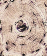 <p>circular structural units of compact bone, comprised of multiple concentric layers of calcified matrix (lamellae) surrounding a central canal </p>