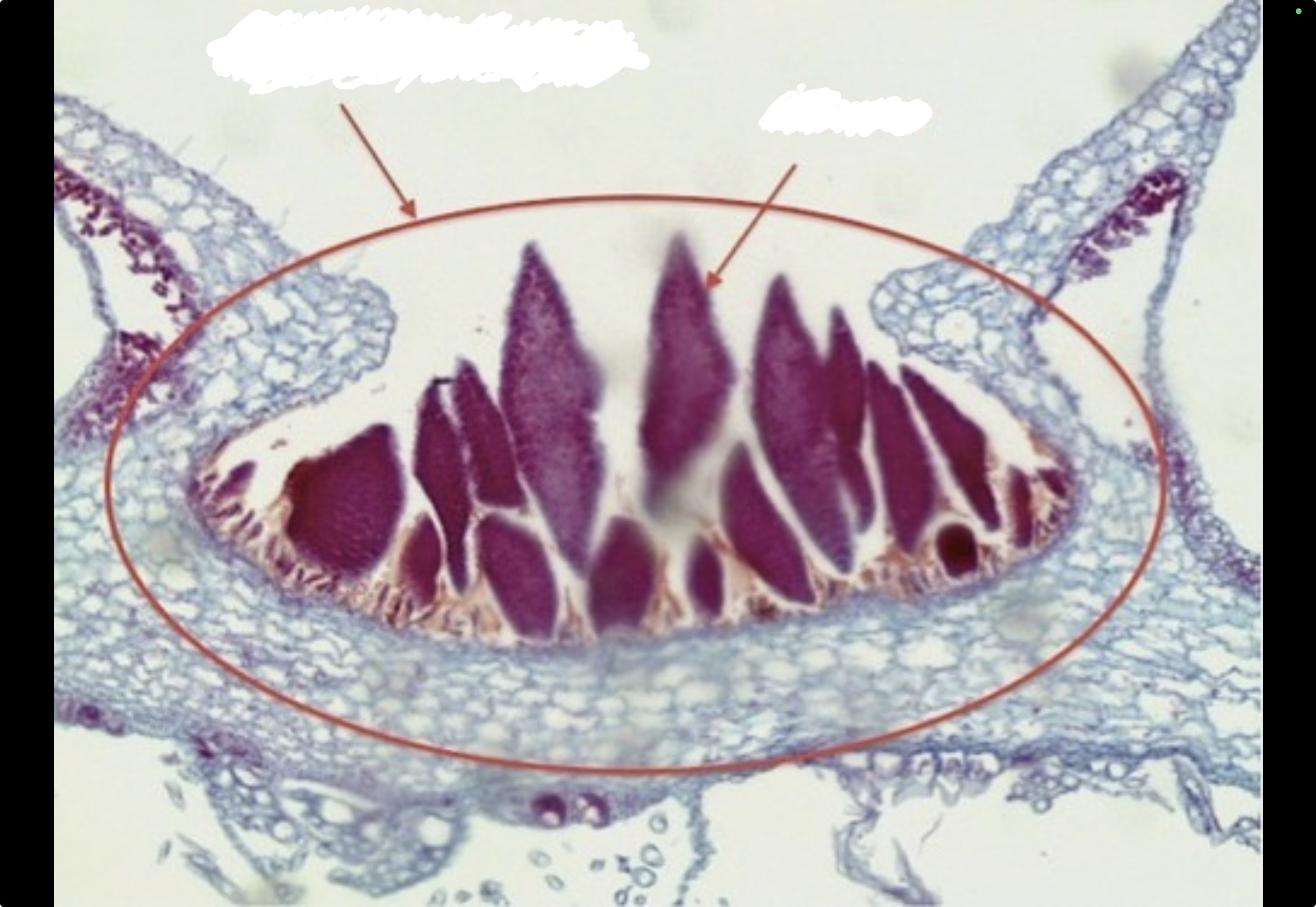 <p>Identify the gamme and gamme cup</p>