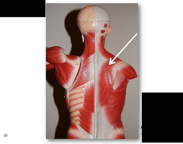 <p>What muscle is this?</p>